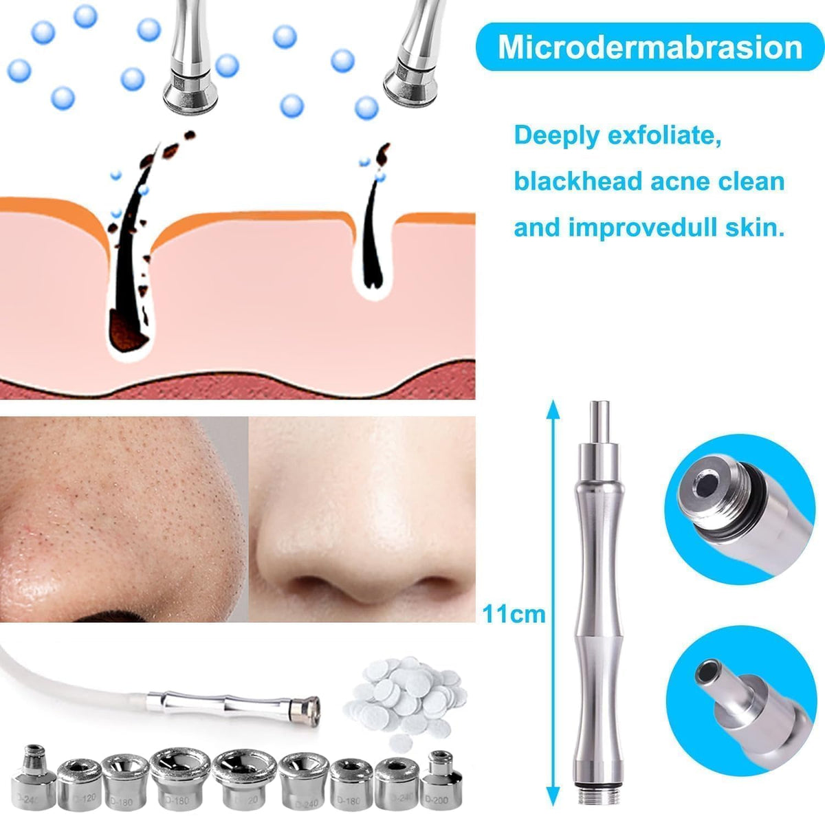 ZEIZOMZER Acne and blackhead removal potential on a clean complexion.