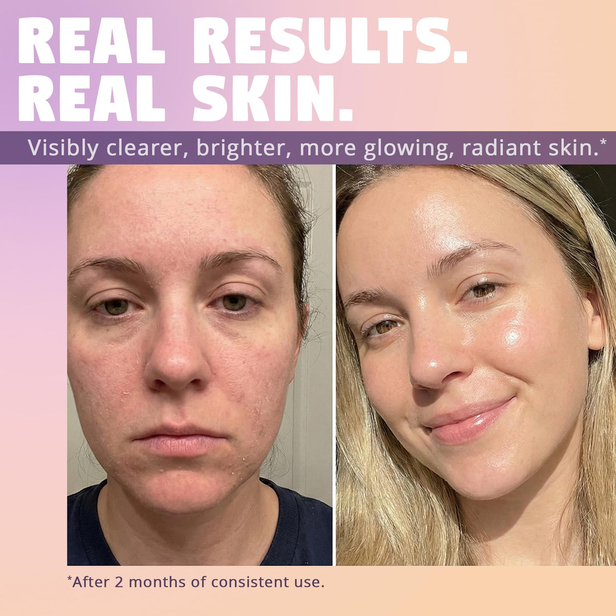 Glow impact image suggesting brighter skin with Zen Dew snail serum.