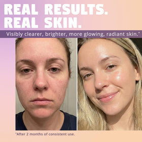 Glow impact image suggesting brighter skin with Zen Dew snail serum.