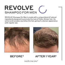 Zenagen Revolve label closeup communicates modern ingredients supporting fuller-looking hair.