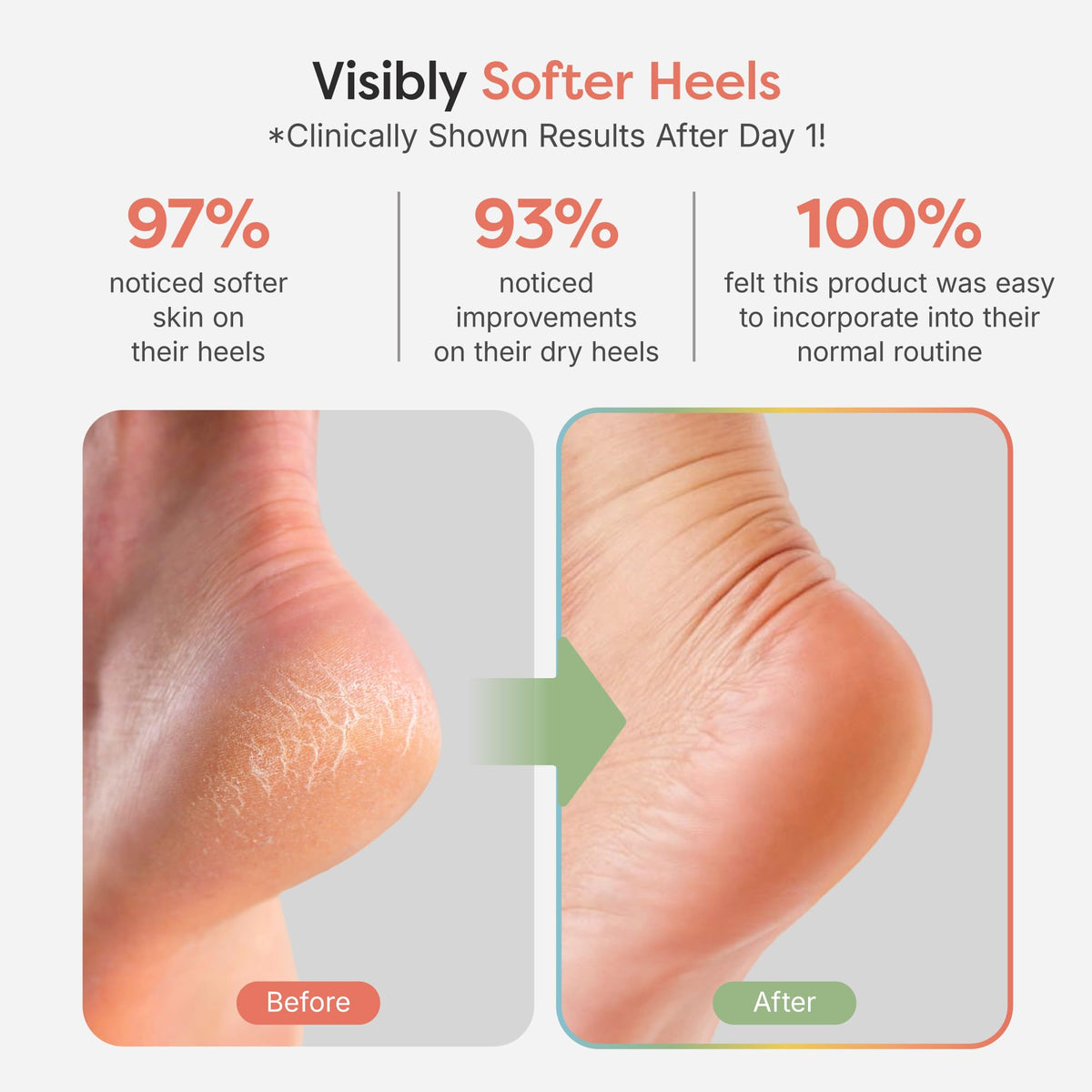 ZenToes open-toe design promotes comfortable overnight wear and easy removal.