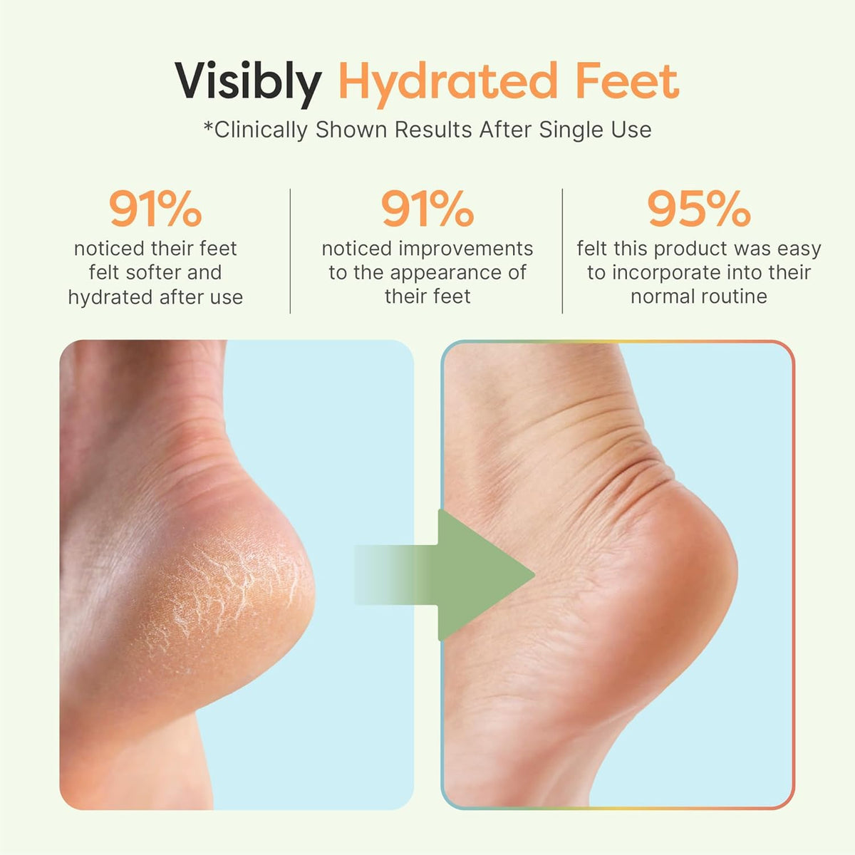 Overnight foot care that softens rough skin while you sleep