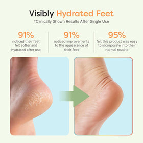 Overnight foot care that softens rough skin while you sleep
