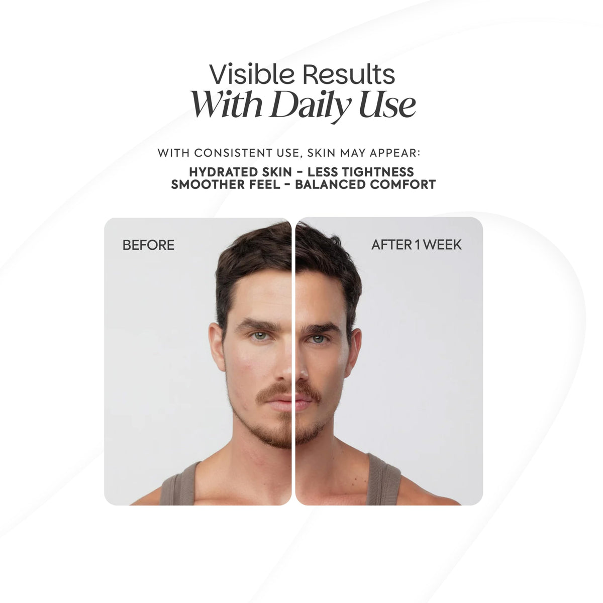 Zenttu ceramide NP and Madecassoside detail reinforces moisture balance.