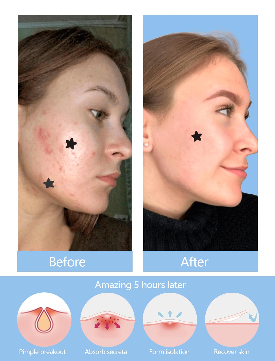 ZHAOLIESM cica oil patch, soothing shield for sensitive skin