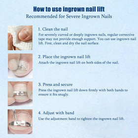 Zinweyton discreet toenail straightener fits inside shoes for daily wear.