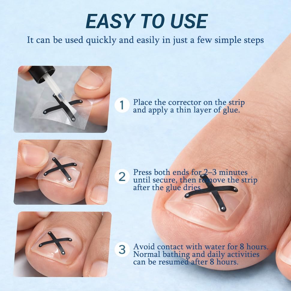 Zinweyton ingrown toenail strips stay secure in wet conditions.