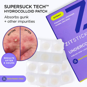 ZitSticka hydrocolloid patch on clean skin blending with makeup