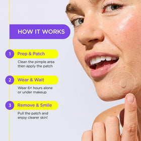 ZitSticka ingredient panel highlights Tea Tree, Cica, and Azelaic Acid