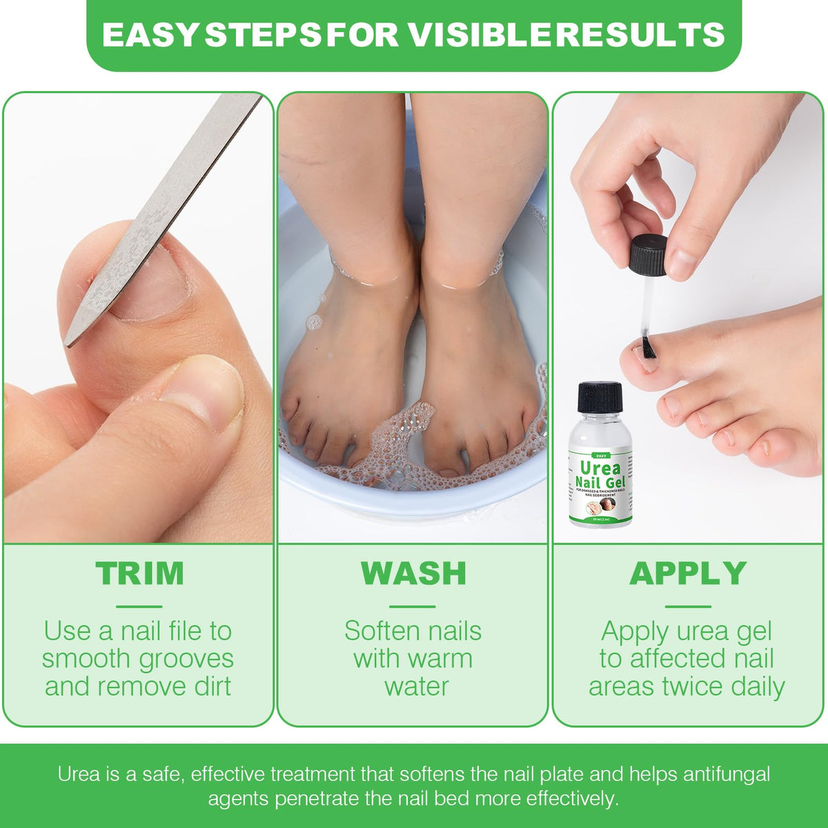 ZOXY Urea Nail Gel 40% massaged into the nail for quick absorption.