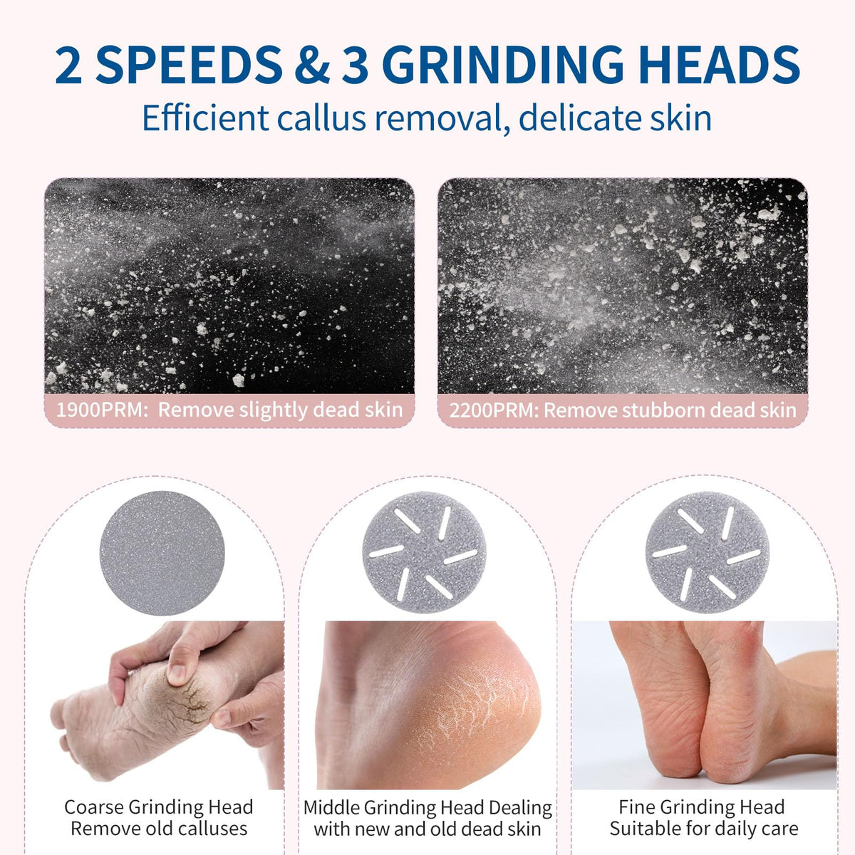 ZOZOO three roller heads close-up for versatile foot care