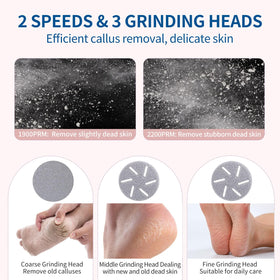 ZOZOO three roller heads close-up for versatile foot care