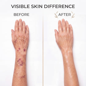 ZRRTXV Reunoa Bruise Defense Serum texture swatch highlights lightweight, non-greasy feel.