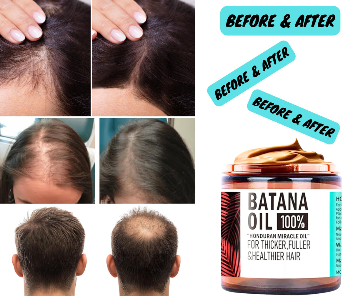 ZVINA Batana Hair Growth Oil on damaged ends indicating repair