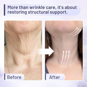 ZZILME decollete tightening massage closeup promotes firmer décolleté skin.
